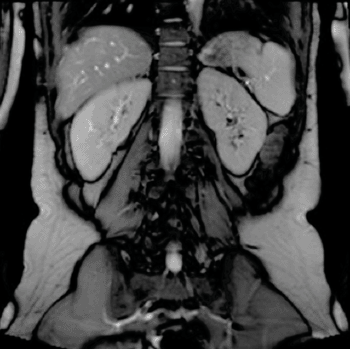 Image: Adult MRI scan. Using MRI and blood tests to establish the cause of death in fetuses and newborn babies is virtually as accurate as a standard autopsy (Photo courtesy of the Great Ormond Street Hospital for Children). Image: Adult MRI scan. Using MRI and blood tests to establish the cause of death in fetuses and newborn babies is virtually as accurate as a standard autopsy (Photo courtesy of the Great Ormond Street Hospital for Children).